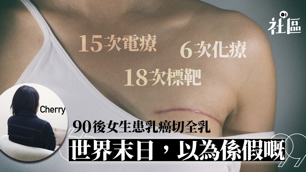 乳癌篩查 90後女生患乳癌曾15次電療 18次標靶 6次化療 香港01 社區專題