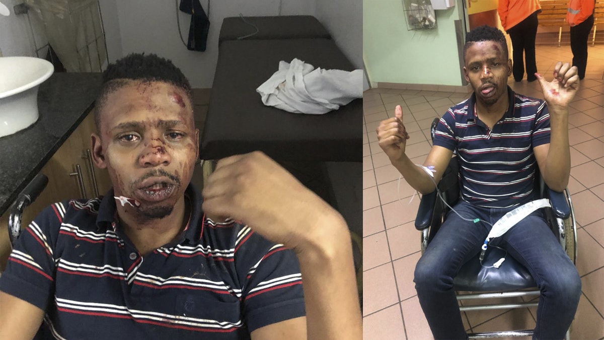 【種族歧視】南非黑人主播欲救遇車禍白人 反被打至血流滿面暈倒 【種族歧視】南非黑人主播欲救遇車禍白人 反被打至血流滿面暈倒