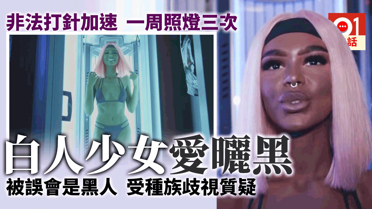 曬黑成癮 無視患癌愛滋風險打助曬針白人少女太似黑人遭辱罵 香港01 熱爆話題 曬黑成癮 無視患癌愛滋風險打助曬針白人少女太似黑人遭辱罵 香港01 熱爆話題
