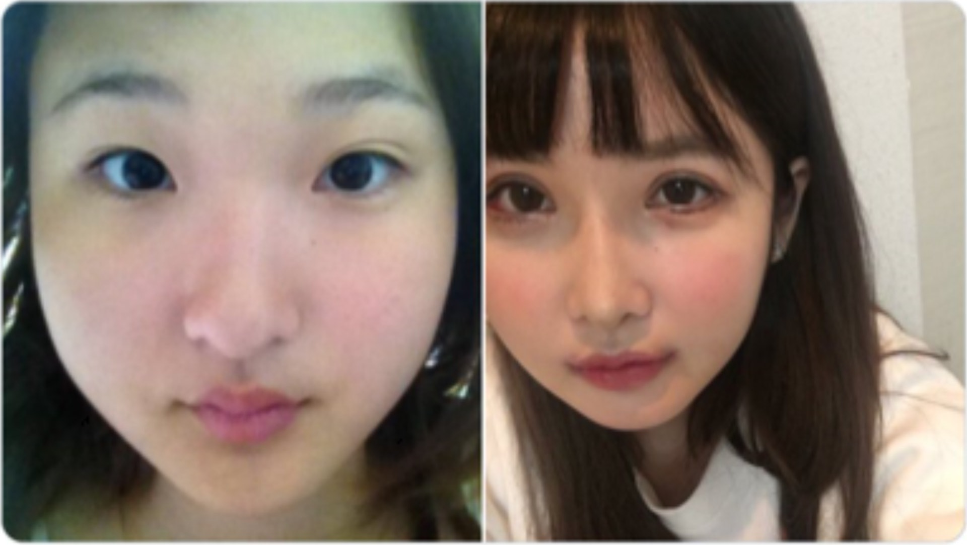 左邊是5年前,還未整容的Ikiri小姐,右邊是2018年版本。(Twitter@ikirichan) 左邊是5年前,還未整容的Ikiri小姐,右邊是2018年版本。(Twitter@ikirichan)