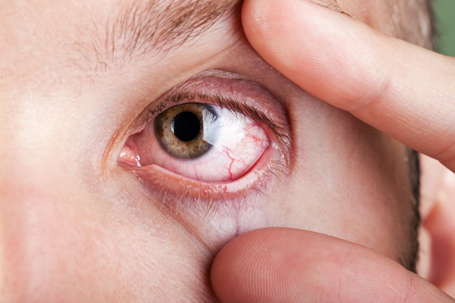 葉黃素及玉米黃素對預防眼部疾病極其有益。（GettyImages）