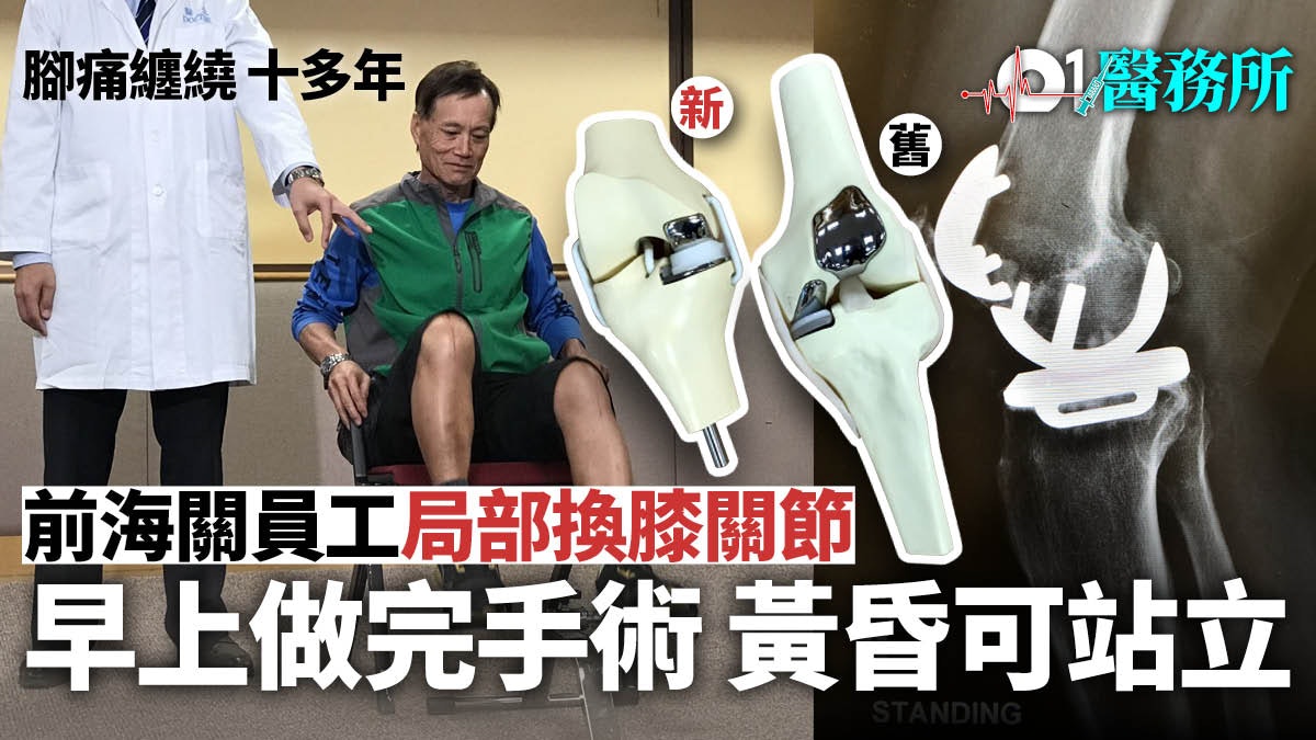 局部膝關節置換術保留病人完整骨骼加快康復最快術後一天可出院 局部膝關節置換術保留病人完整骨骼加快康復最快術後一天可出院