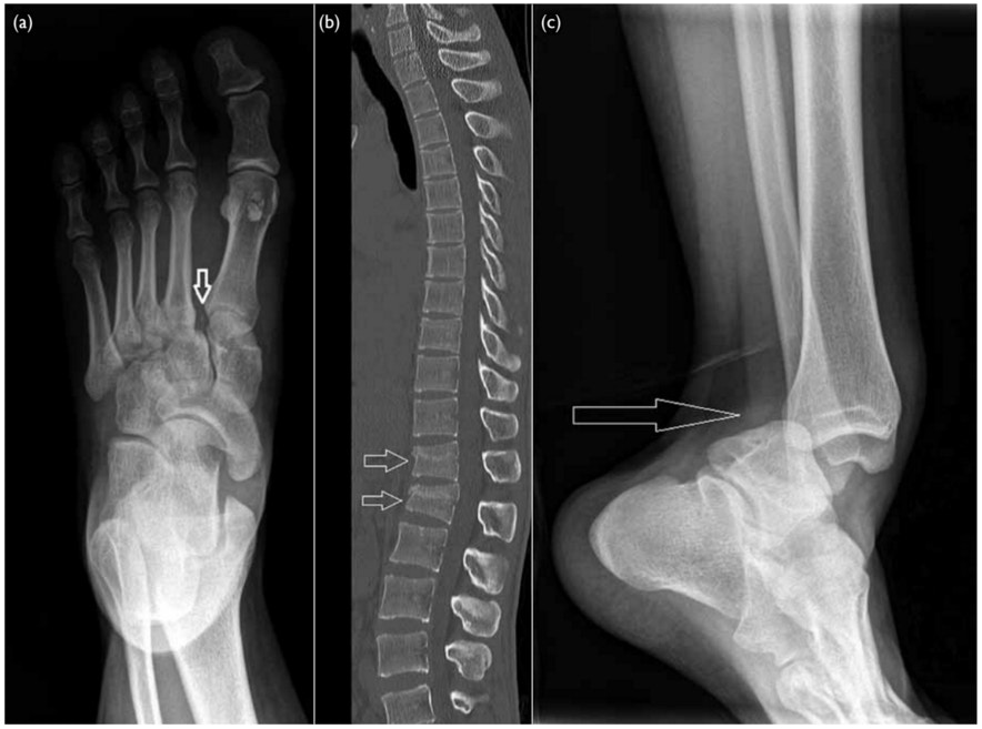 跳彈床致骨折脫臼兩個月8人受傷入院 香港01 社會新聞