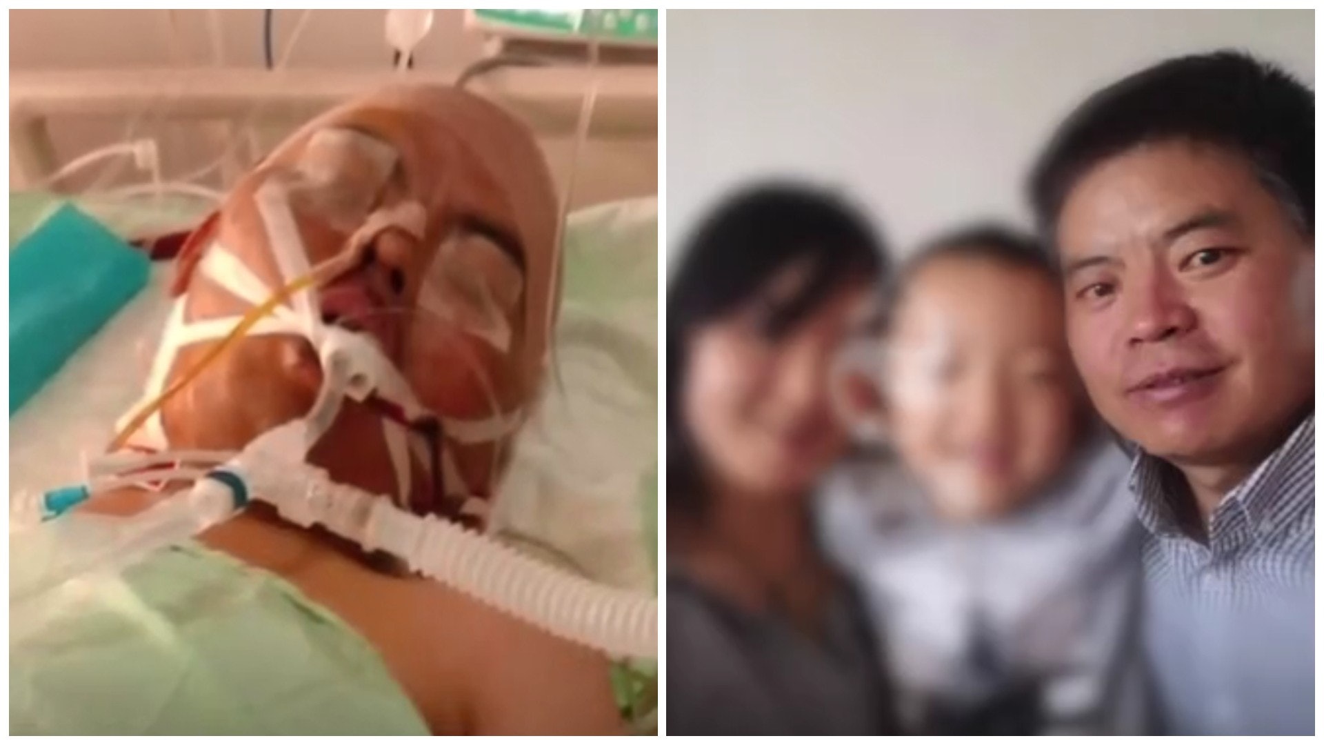 【診金逾百萬】西藏縣官患高原肺水腫險死 妻網上眾籌為夫治病 【診金逾百萬】西藏縣官患高原肺水腫險死 妻網上眾籌為夫治病