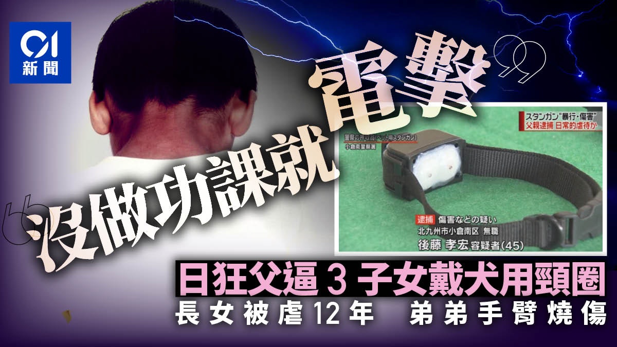 日本狠父逼3子女配戴犬用防吠頸圈 沒做功課就電擊 香港01 即時國際