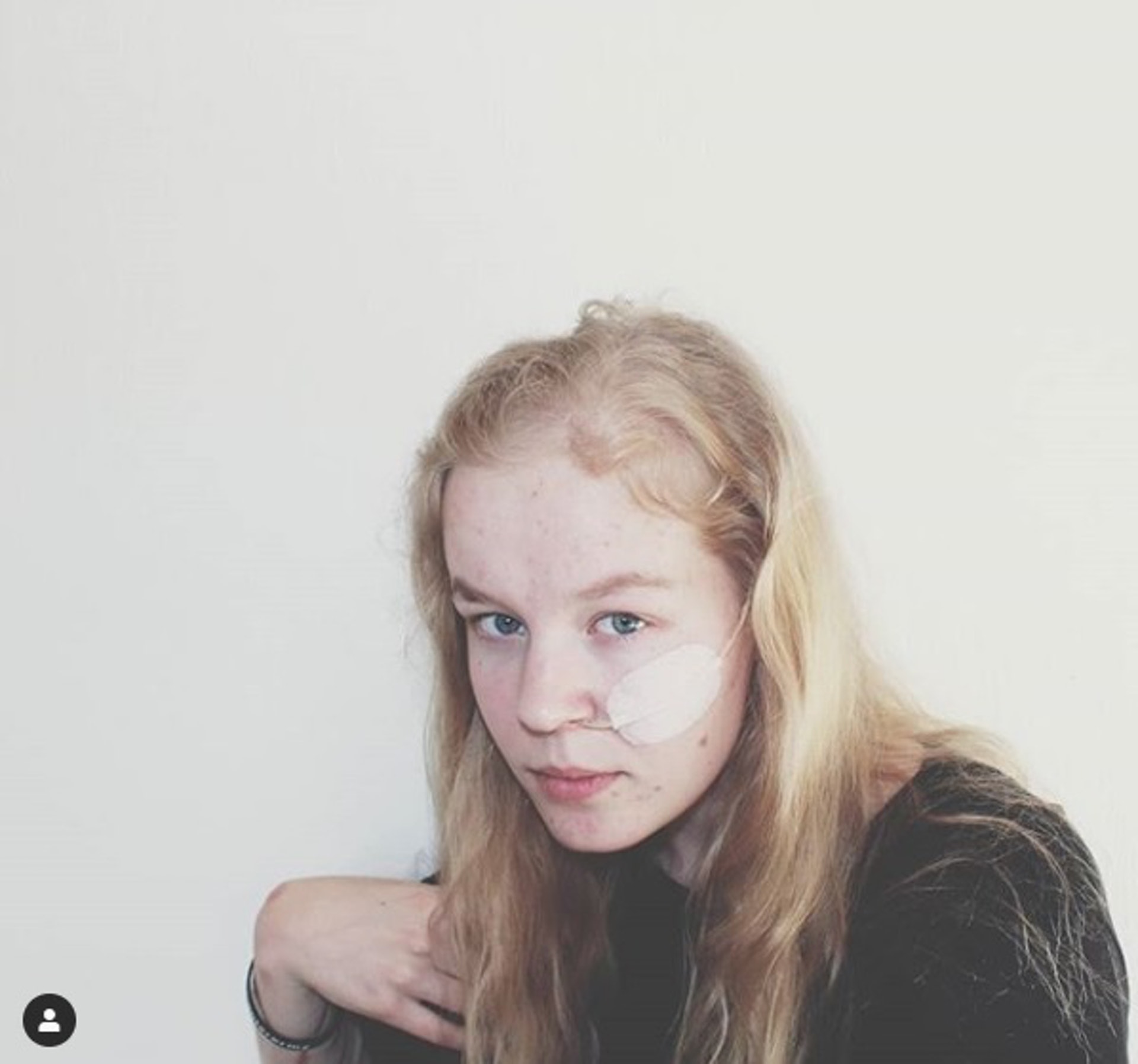 波托芬童年時被多次性侵,導致患上創傷後遺症、抑鬱症及厭食症。(Instagram@Noa Pothoven圖片)