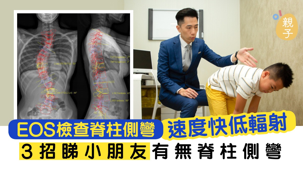 【親子健康】3招幫助小朋友檢查脊柱問題 轉介EOS低輻射速度快 【親子健康】3招幫助小朋友檢查脊柱問題 轉介EOS低輻射速度快