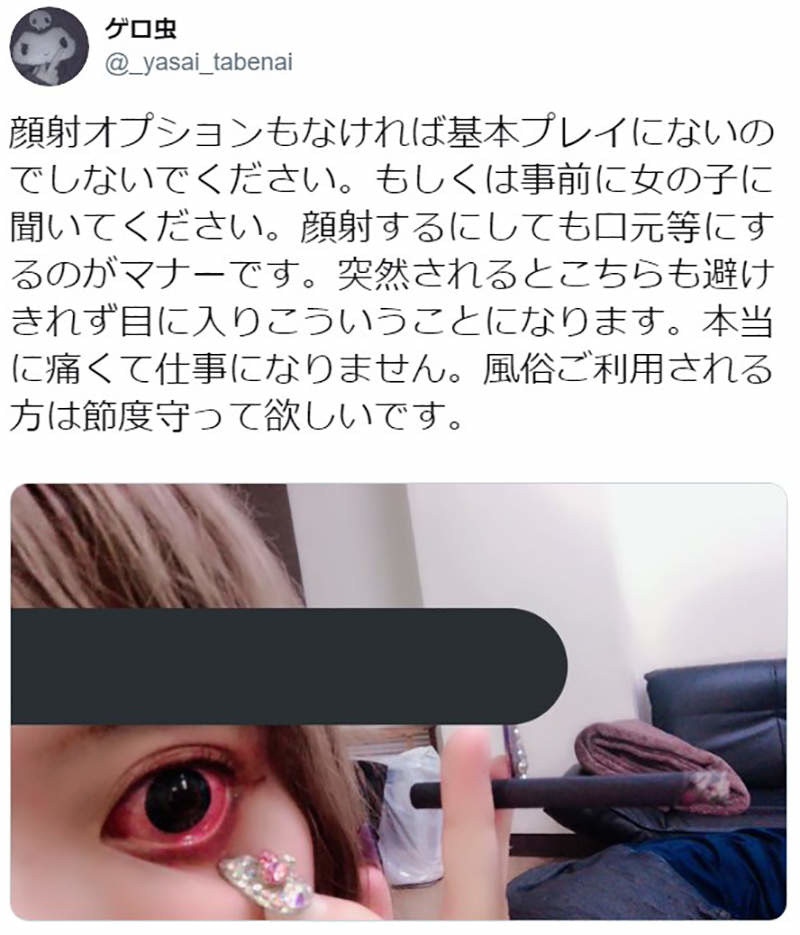 有名從事風俗業的女網民指，被「顏射」後就患上角膜炎。（Twitter「_yasai_tabenai」圖片）