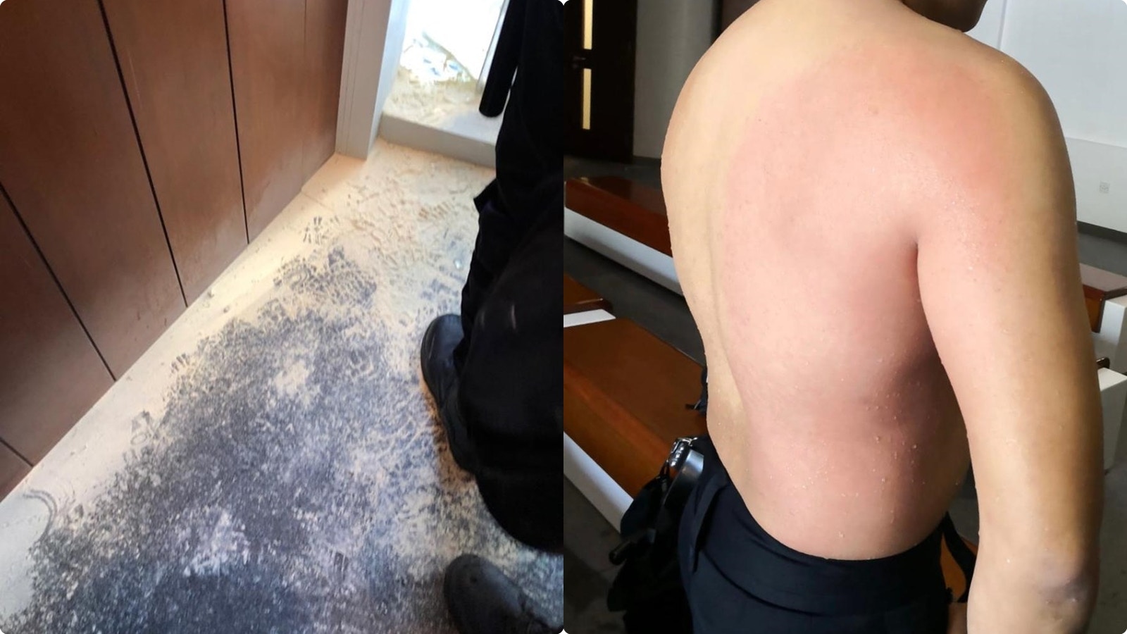 警方上傳懷疑石灰粉照片，以及警員受傷照片。(香港警察facebook)