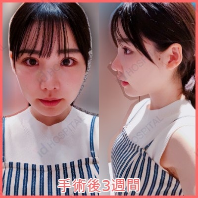 日本av女優深田詠美走紅韓媒爆整容前照片網民驚嘆手術超成功 香港01 開罐