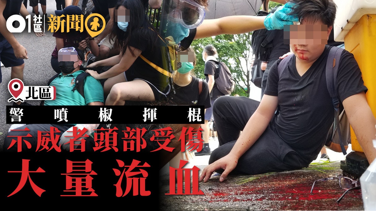 光復上水 警揮棍追打示威者有人被擊中頭部流血 香港01 18區新聞