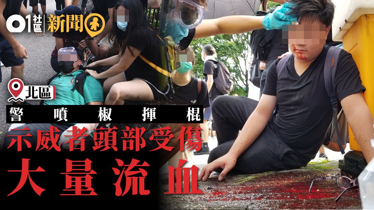 光復上水 警揮棍追打示威者有人被擊中頭部流血 香港01 18區新聞 光復上水 警揮棍追打示威者有人被擊中頭部流血 香港01 18區新聞