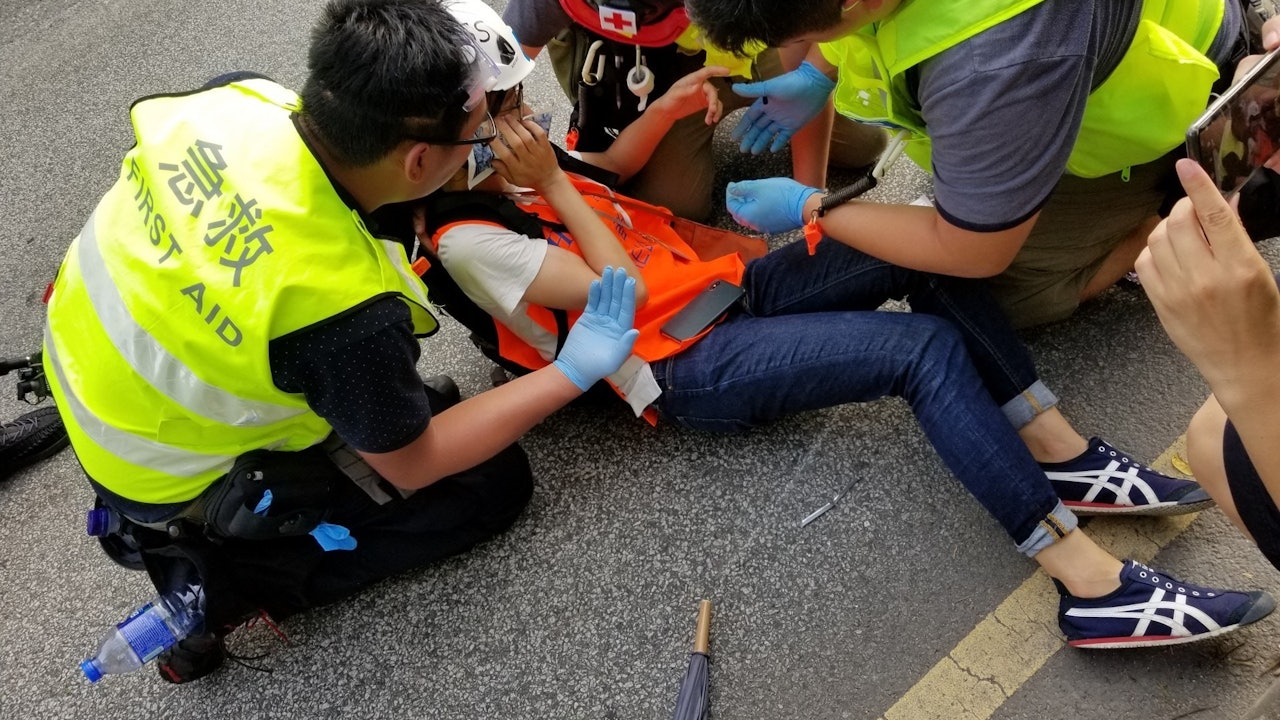 【光復上水】法新社女記者遭人拉跌 臉部手腳受傷 已尋回相機 【光復上水】法新社女記者遭人拉跌 臉部手腳受傷 已尋回相機