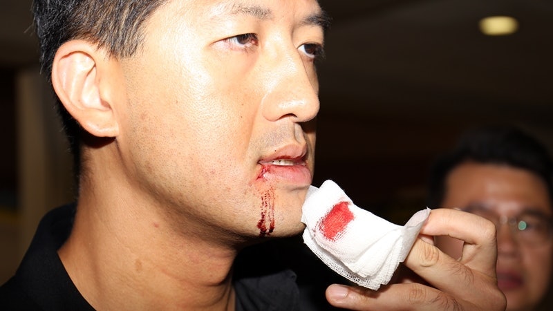 林卓廷渉721暴動|林指白衣人全無顧忌 對鏡頭仍耀武揚威地打人 林卓廷渉721暴動|林指白衣人全無顧忌 對鏡頭仍耀武揚威地打人