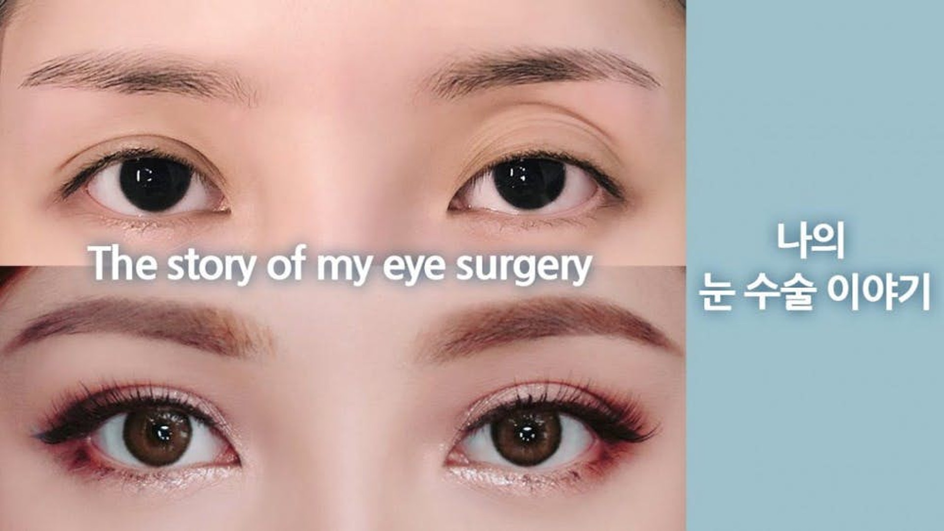 韓國美妝教主pony大方承認兩次整容自爆因天生缺陷備受困擾 香港01 即時娛樂