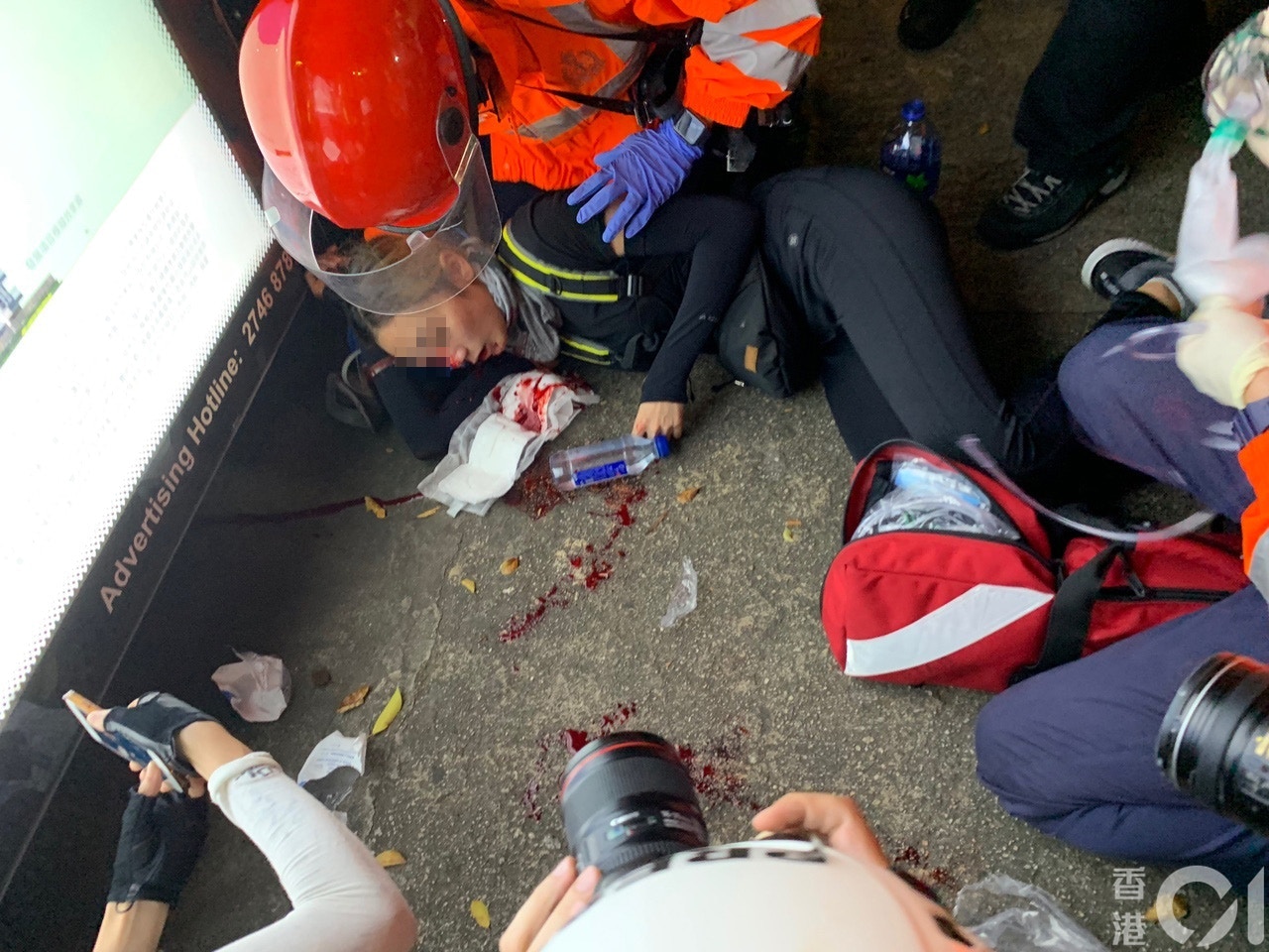 日前於尖沙嘴被射爆眼球的女傷者疑為獸醫助護。(資料圖片) 日前於尖沙嘴被射爆眼球的女傷者疑為獸醫助護。(資料圖片)