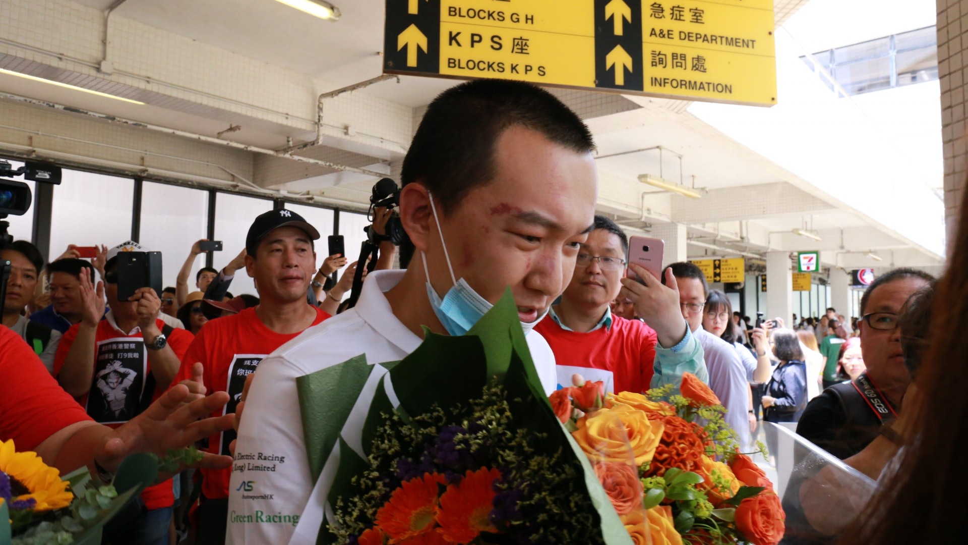 【機場集會】工聯會接出院 環時記者付國豪:我不應受暴力對待 【機場集會】工聯會接出院 環時記者付國豪:我不應受暴力對待