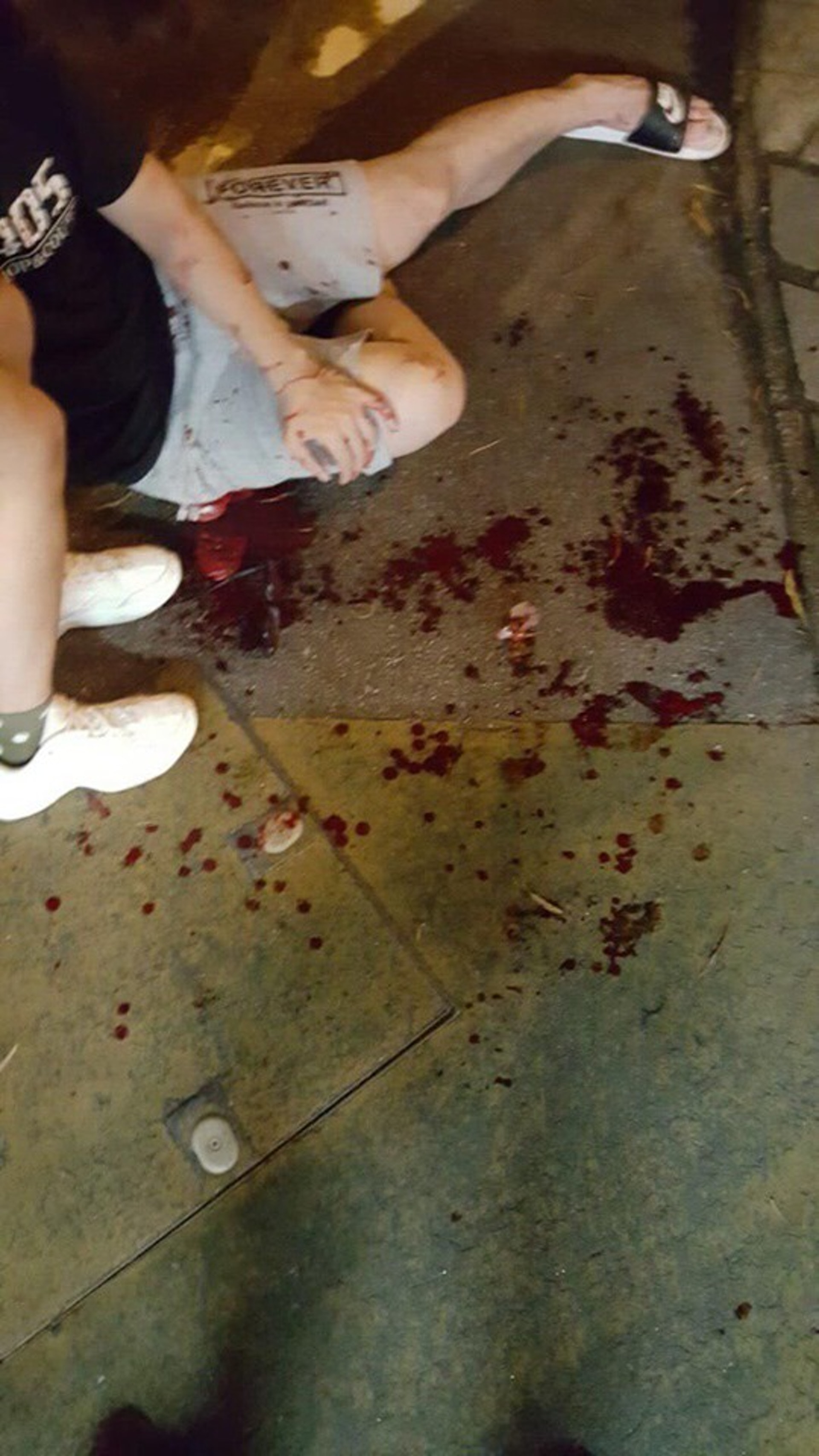 女傷者嚴重受傷,滿地鮮血。(網上圖片)