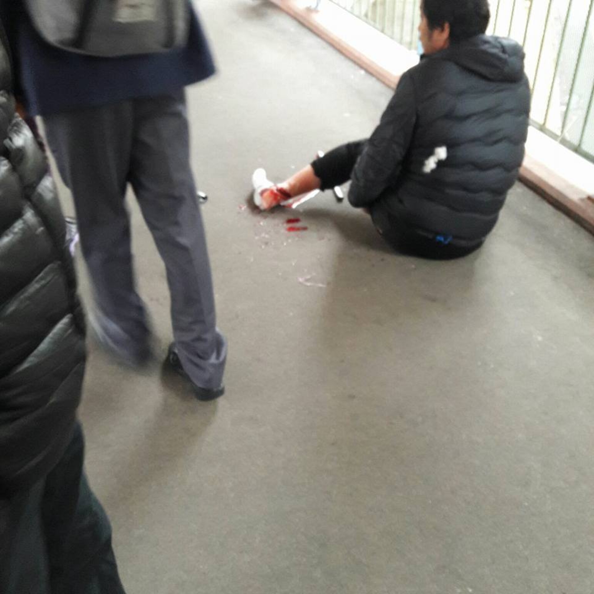 今晨上水一名運鈔男被南亞賊搶劫,反抗被斬腳筋,失去價值港幣400萬元的外幣。(網民Judy Lo上載至fb「香港突發事故報料區」圖片) 今晨上水一名運鈔男被南亞賊搶劫,反抗被斬腳筋,失去價值港幣400萬元的外幣。(網民Judy Lo上載至fb「香港突發事故報料區」圖片)