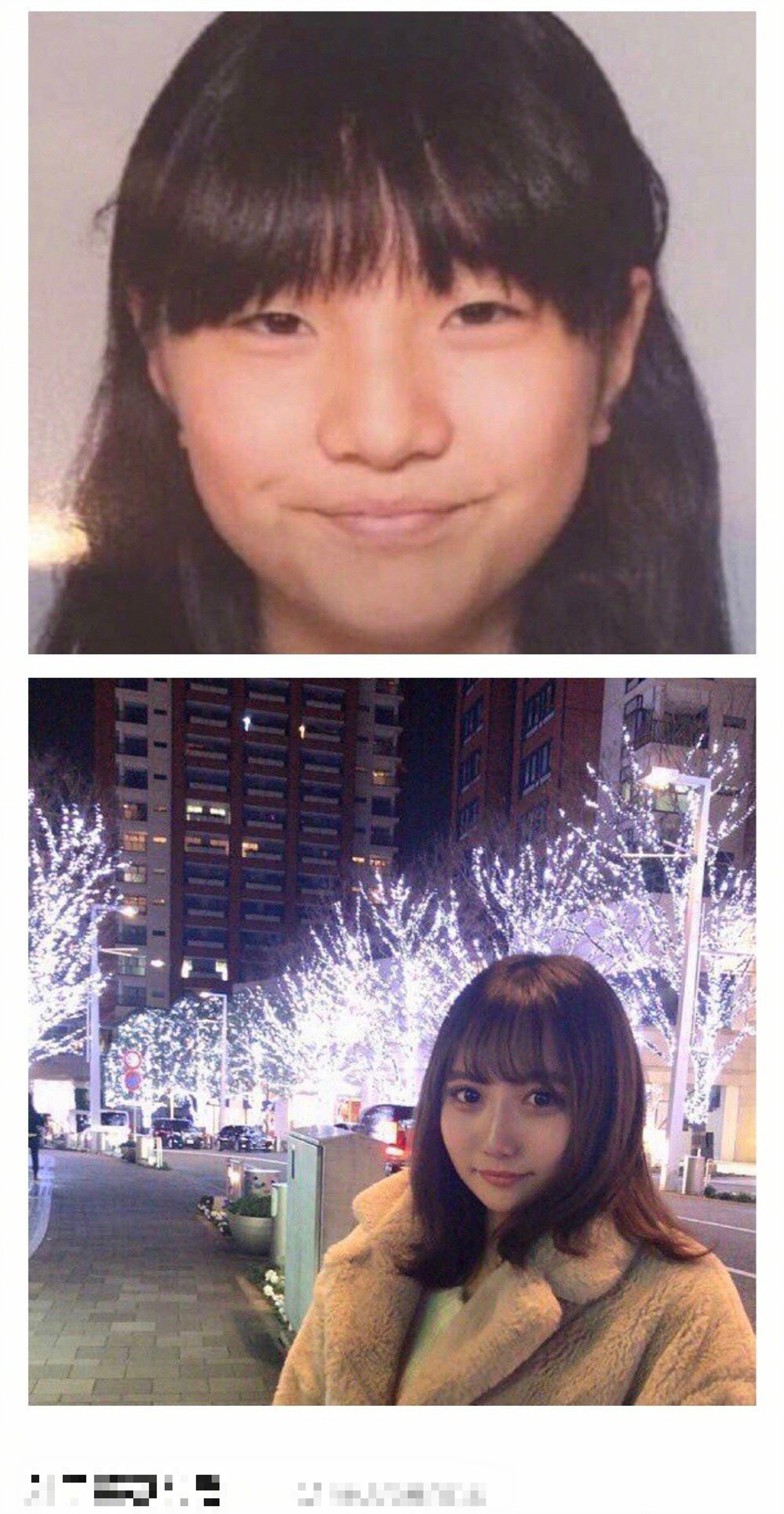 nemui整容前後樣子對比。(微博圖片) nemui整容前後樣子對比。(微博圖片)