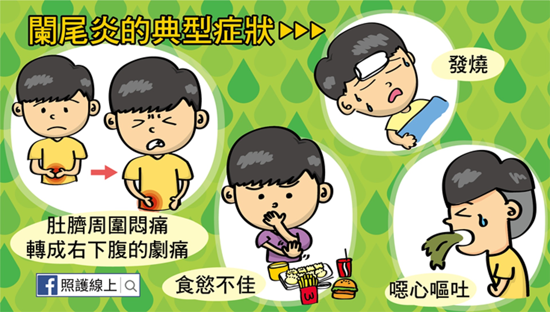 闌尾炎的典型症狀(照護線上授權使用) 闌尾炎的典型症狀(照護線上授權使用)