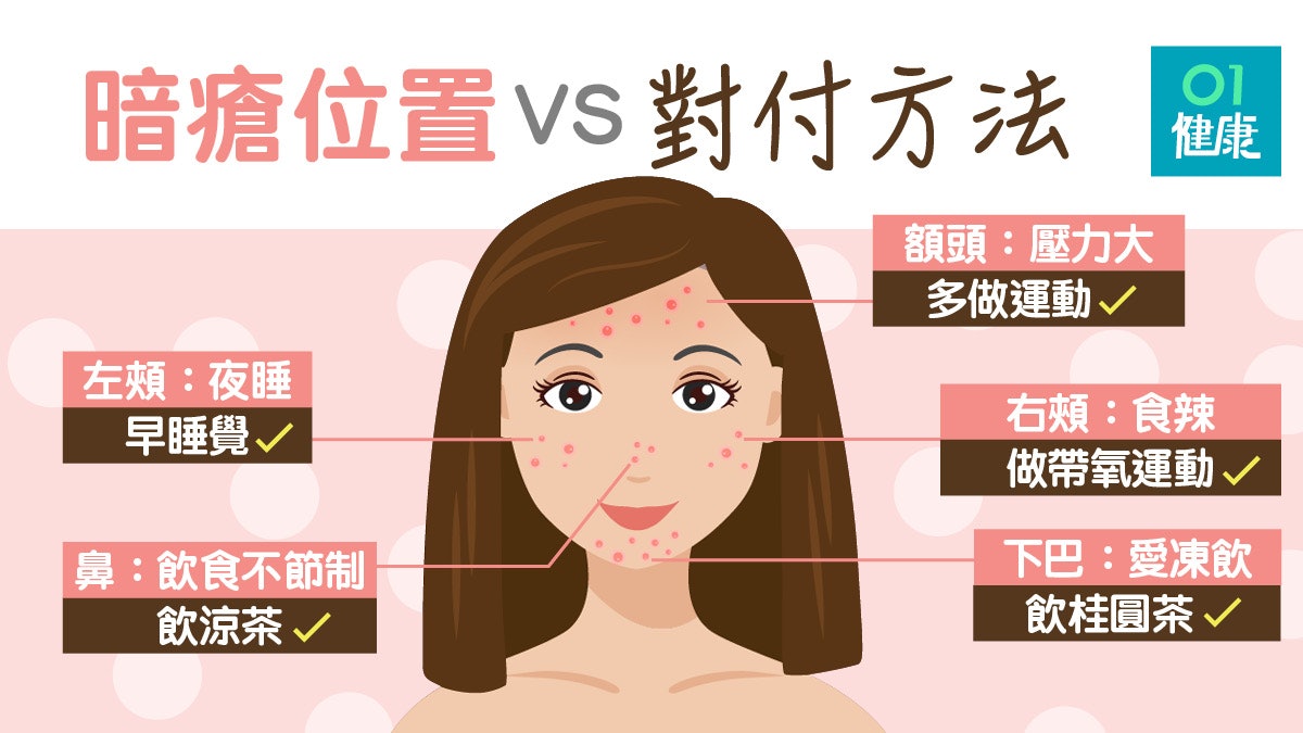 【暗瘡】生額頭心火盛左面太夜瞓!臉部5位置治暗瘡涼茶有冇效? 【暗瘡】生額頭心火盛左面太夜瞓!臉部5位置治暗瘡涼茶有冇效?