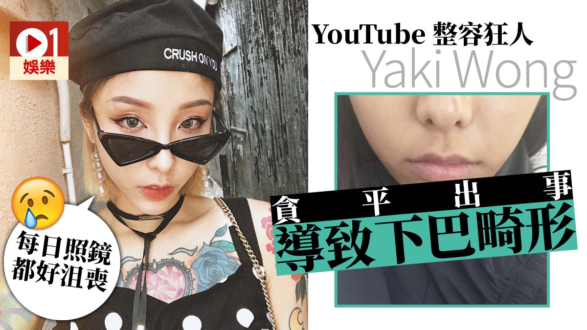 Youtuber Yaki下巴整容失敗痛苦度日後悔年少無知亂打針 香港01 即時娛樂