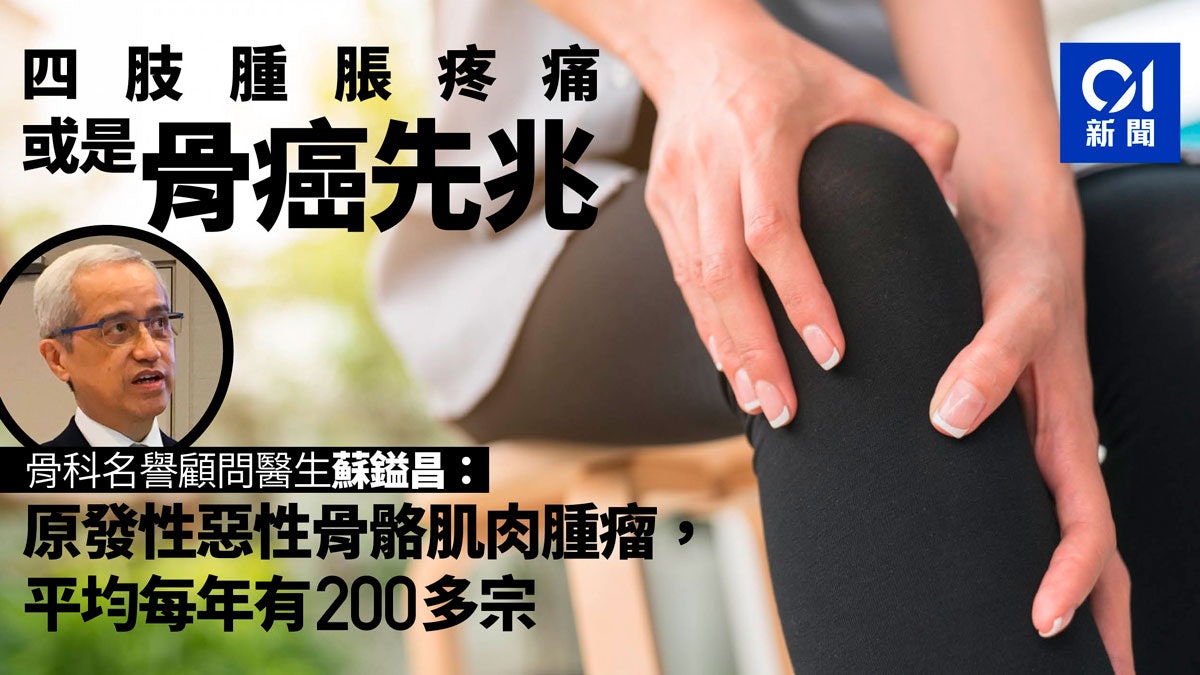 四肢腫痛或是骨癌警號 醫生:每年200宗個案 誤診率達五分一 四肢腫痛或是骨癌警號 醫生:每年200宗個案 誤診率達五分一