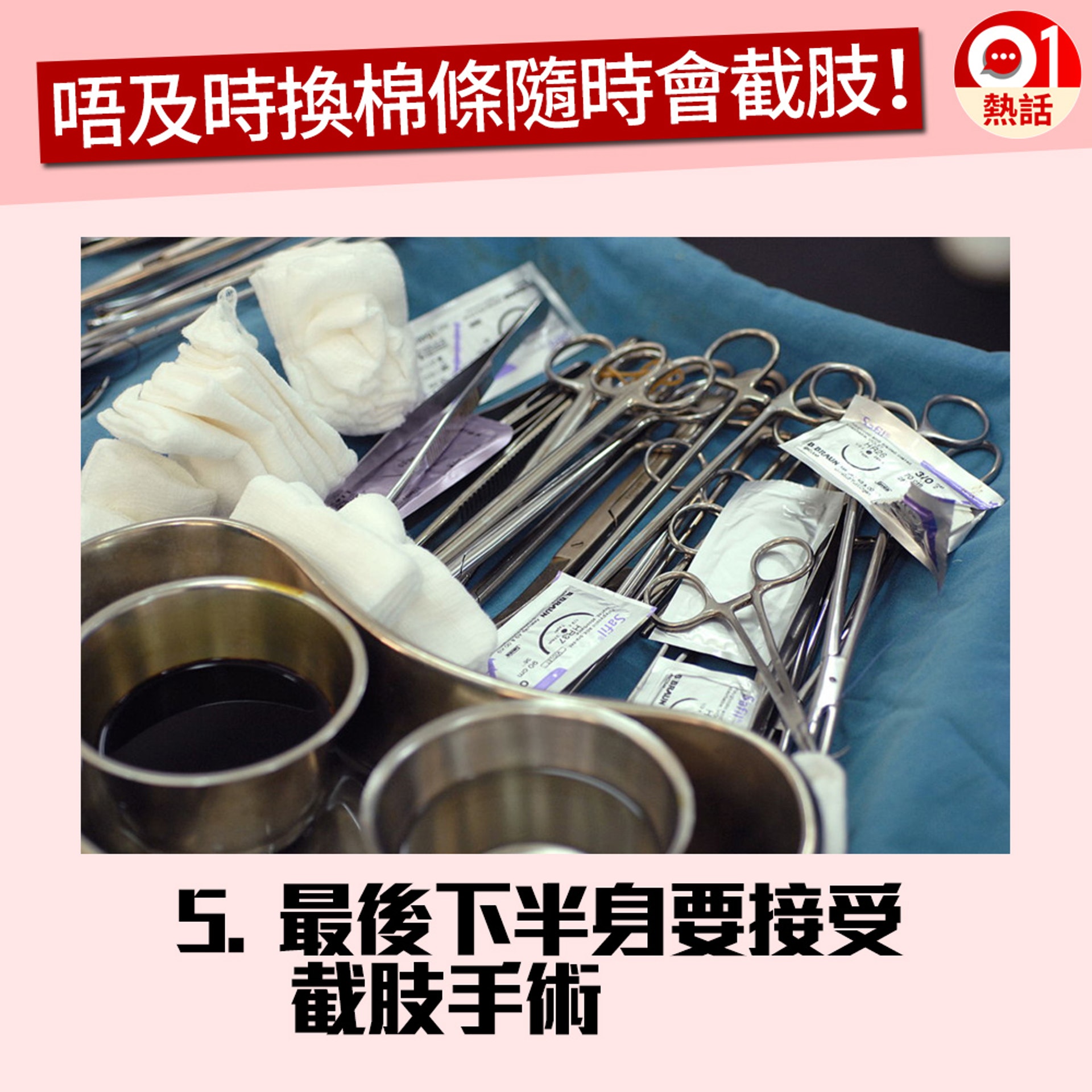 【健康百科#衛生棉條】4. 最後因為細菌感染而需要截肢。(GettyImages/視覺中國/香港01製圖) 【健康百科#衛生棉條】4. 最後因為細菌感染而需要截肢。(GettyImages/視覺中國/香港01製圖)