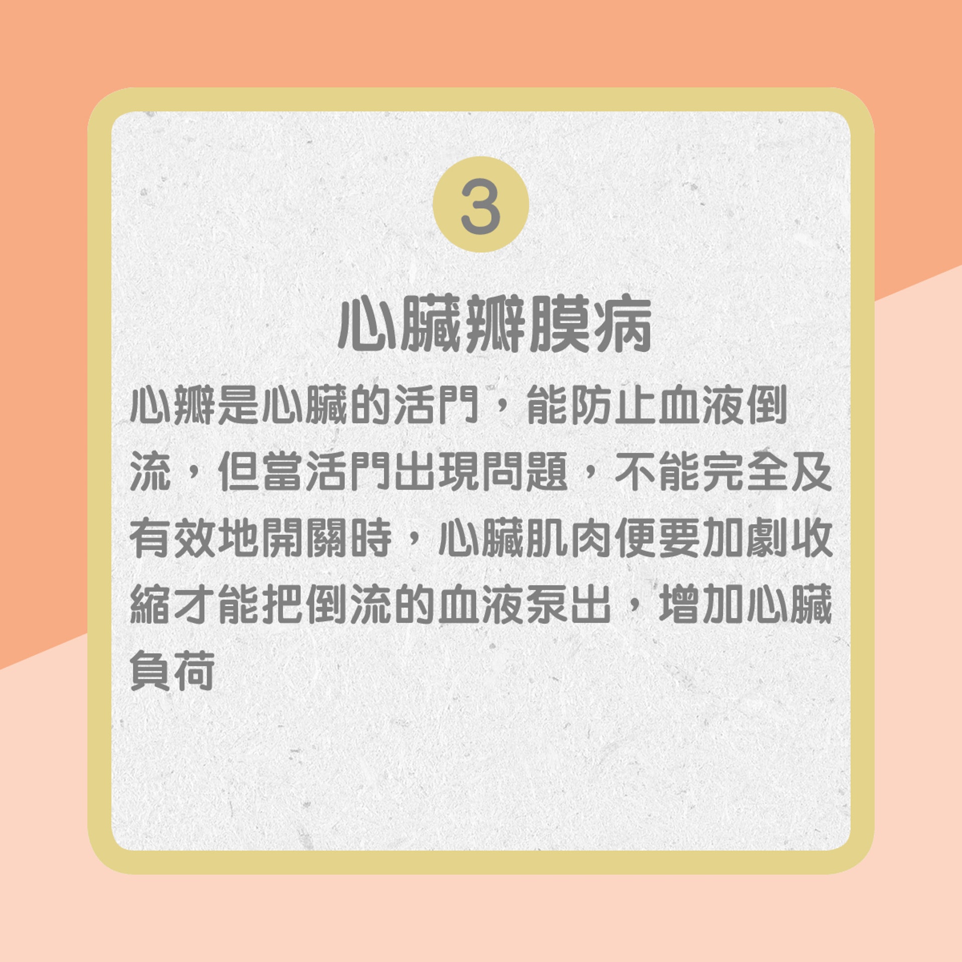 【心臟衰竭部份成因】3. 心臟瓣膜病(01製圖) 【心臟衰竭部份成因】3. 心臟瓣膜病(01製圖)