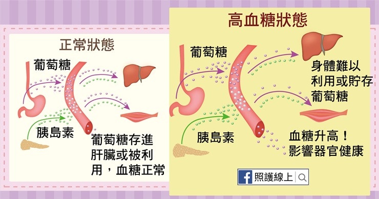 高血糖狀態(照護線上授權使用) 高血糖狀態(照護線上授權使用)