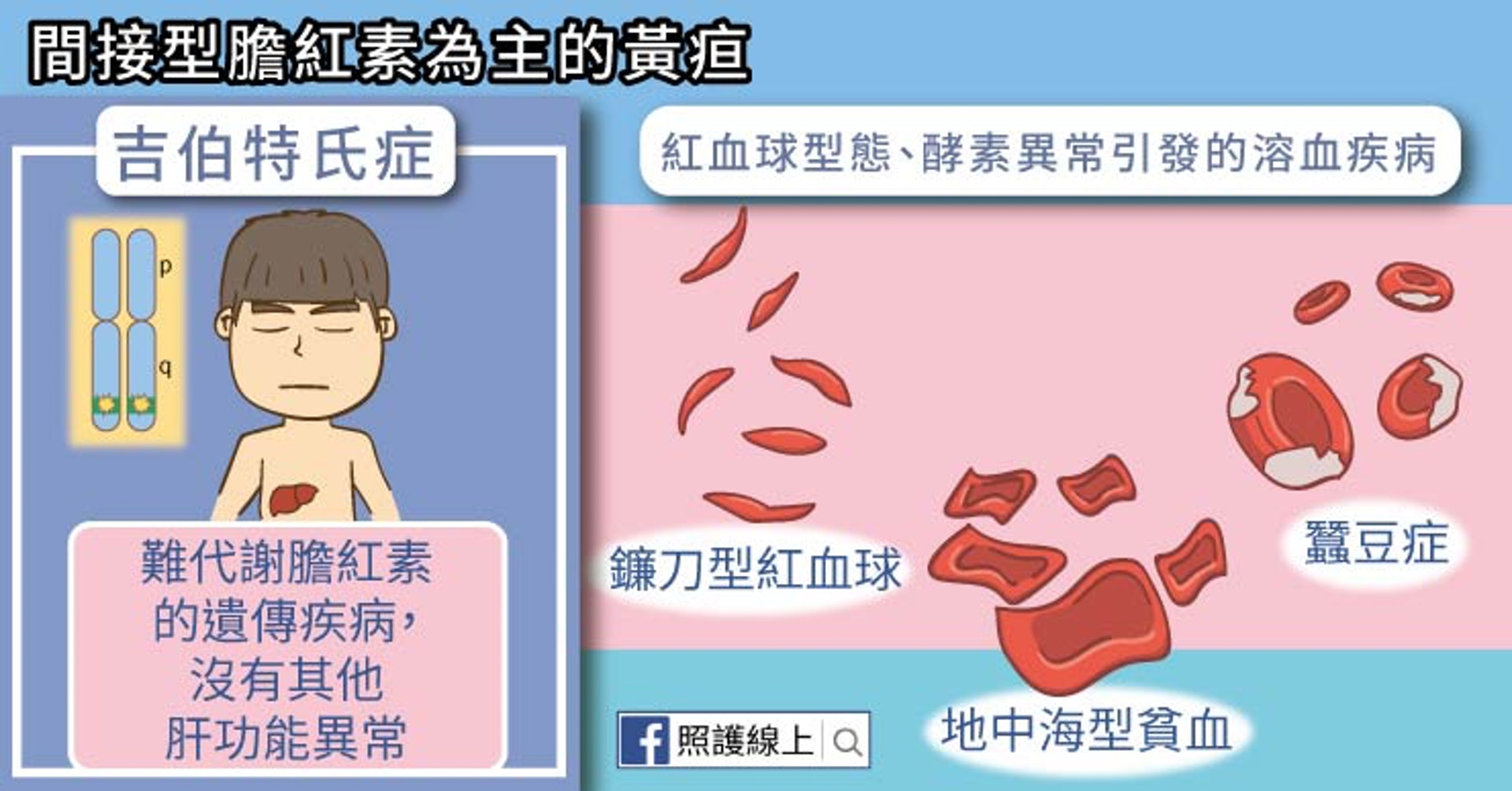 間接型膽紅素為主的黃疸(照護線上授權使用) 間接型膽紅素為主的黃疸(照護線上授權使用)