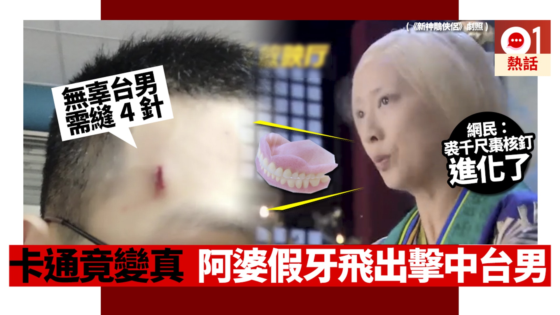 「天有不測之風雲,人有霎時之禍福」,近日一名台男在討論區上分享,說天氣開始轉冷令不少人感冒,而他出去散步的時候,迎面而來的一位婆婆突然打了一個大噴嚏,「她的假牙以時速100公里速度飛出去,我閃不掉,結果假牙狠狠地砸在我的額頭上,害我縫了四針,超痛的!」 台男無辜受傷,不過網民並沒有同情他,反而是盡情取笑!有人笑指故事經過實在太荒唐,以為卡通片才會遇到。另外亦有人認為,婆婆可能是武俠小說中可以使出棗核釘的角色裘千尺。(香港01製圖/《新神鵰俠侶》劇照) 「天有不測之風雲,人有霎時之禍福」,近日一名台男在討論區上分享,說天氣開始轉冷令不少人感冒,而他出去散步的時候,迎面而來的一位婆婆突然打了一個大噴嚏,「她的假牙以時速100公里速度飛出去,我閃不掉,結果假牙狠狠地砸在我的額頭上,害我縫了四針,超痛的!」 台男無辜受傷,不過網民並沒有同情他,反而是盡情取笑!有人笑指故事經過實在太荒唐,以為卡通片才會遇到。另外亦有人認為,婆婆可能是武俠小說中可以使出棗核釘的角色裘千尺。(香港01製圖/《新神鵰俠侶》劇照)