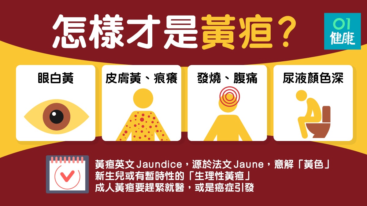 黃疸 膽石或癌症可致黃疸留意眼白 皮膚變黃及深色尿徵狀 香港01 健康