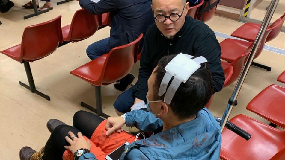 【8.31兩個月】社工被警棍扑穿頭 邵家臻:是警暴最實在的證明 【8.31兩個月】社工被警棍扑穿頭 邵家臻:是警暴最實在的證明