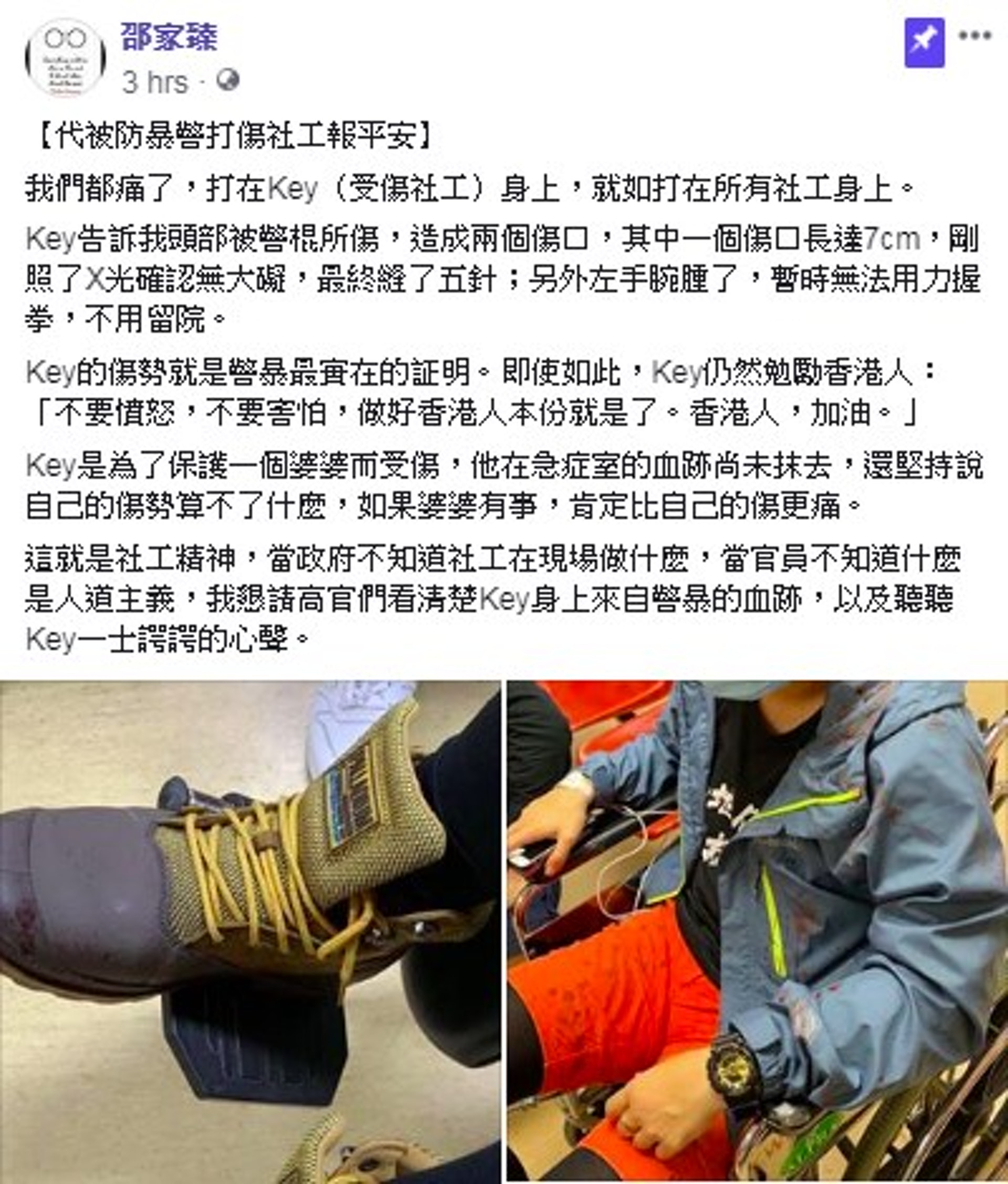 邵家臻在facebook發文關心受傷社工。 邵家臻在facebook發文關心受傷社工。