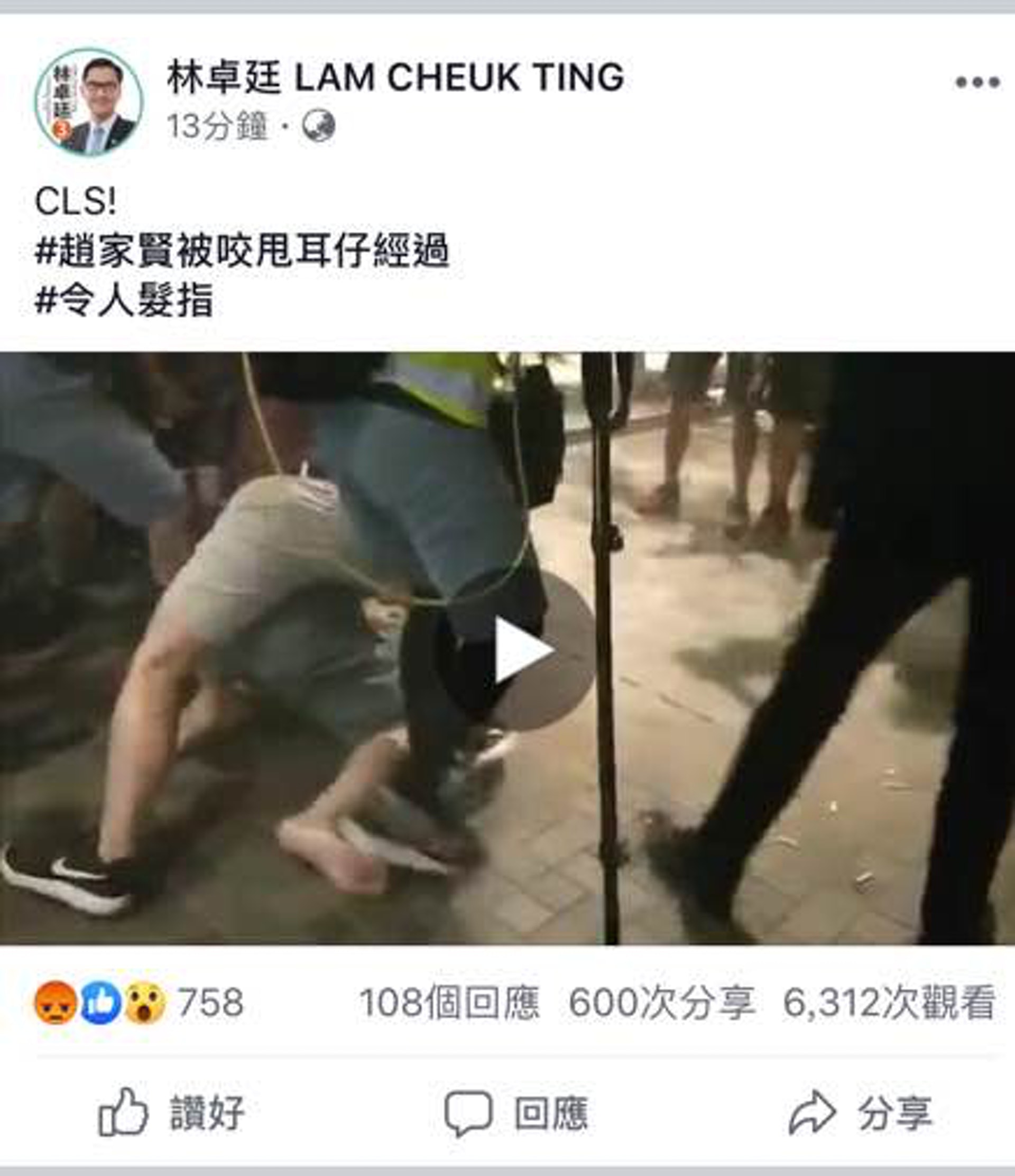 林卓廷在FB上載趙家賢被咬甩耳朵經過。(林卓廷FB截圖) 林卓廷在FB上載趙家賢被咬甩耳朵經過。(林卓廷FB截圖)