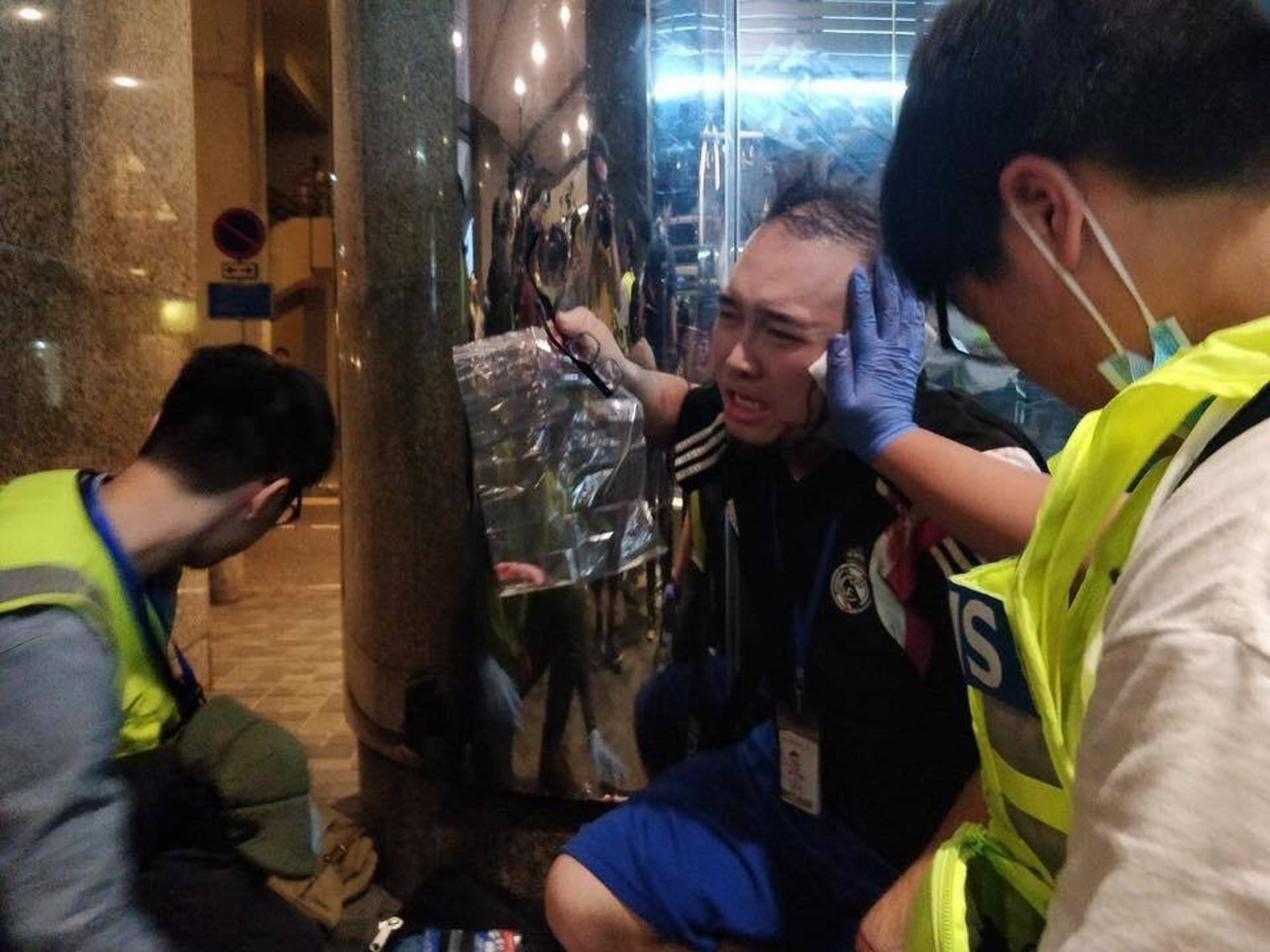 趙蹲在地上接受治理,右手拿著眼鏡和一個透明膠袋,袋中有他自己的耳朵殘肉。(林卓廷fb截圖) 趙蹲在地上接受治理,右手拿著眼鏡和一個透明膠袋,袋中有他自己的耳朵殘肉。(林卓廷fb截圖)