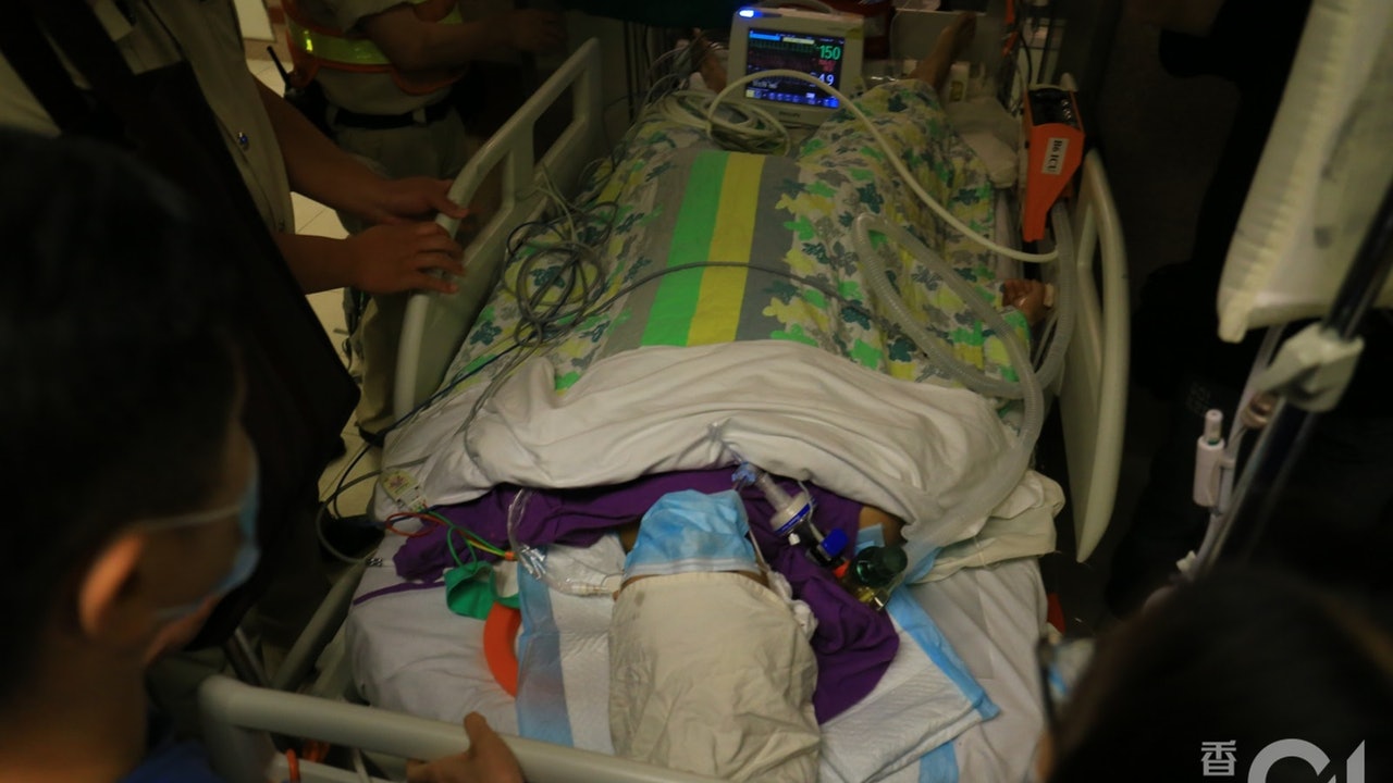 【危殆科大生】 消息:手術麻醉藥力未過 未適合作腦死亡測試 【危殆科大生】 消息:手術麻醉藥力未過 未適合作腦死亡測試