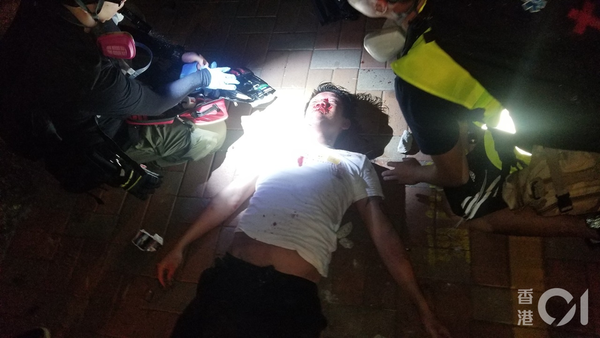 被「私了」的白衣男,血流披面倒地。(王譯揚攝)