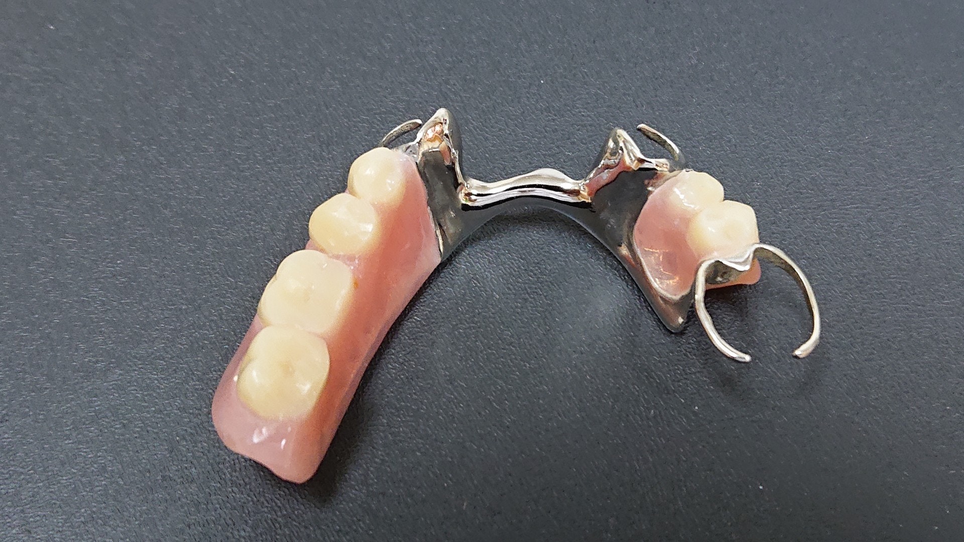 鑲配假牙後，仍需要適應及調校。（廖偉明醫生提供）