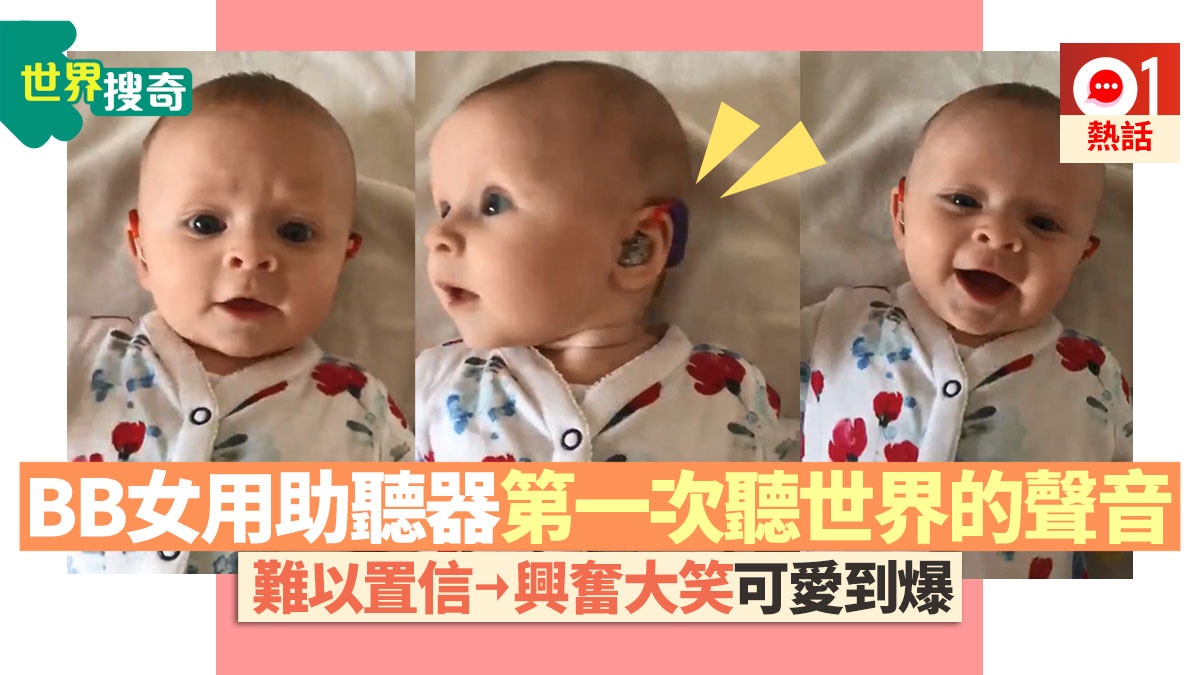 嚴重失聰bb女戴助聽器初聽父母聲音純真反應觸動50萬人心靈