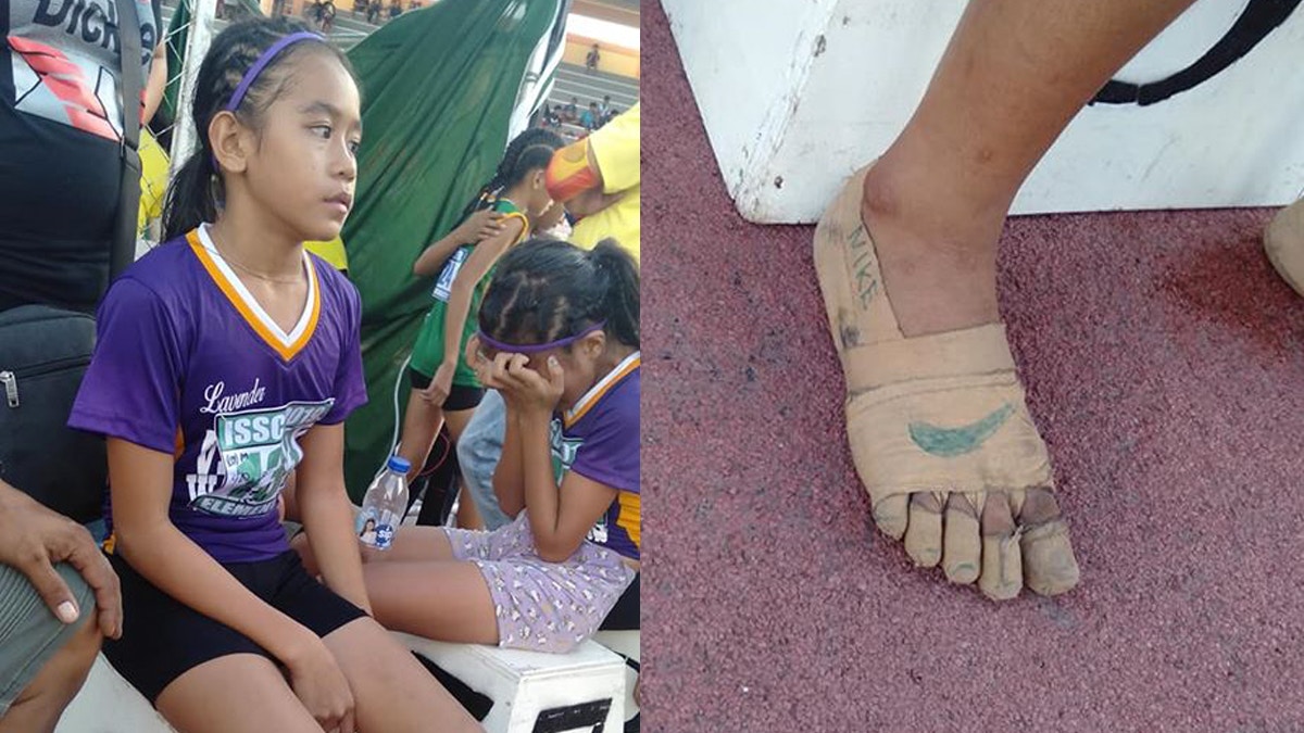 菲律賓11歲女無錢買波鞋　繃帶纏腳自製「NIKE跑鞋」奪3金　