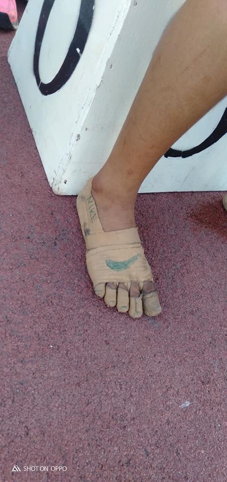 她在繃帶畫上代表知名運動品牌的「剔號」。（Predirick B. Valenzuela fb圖片）