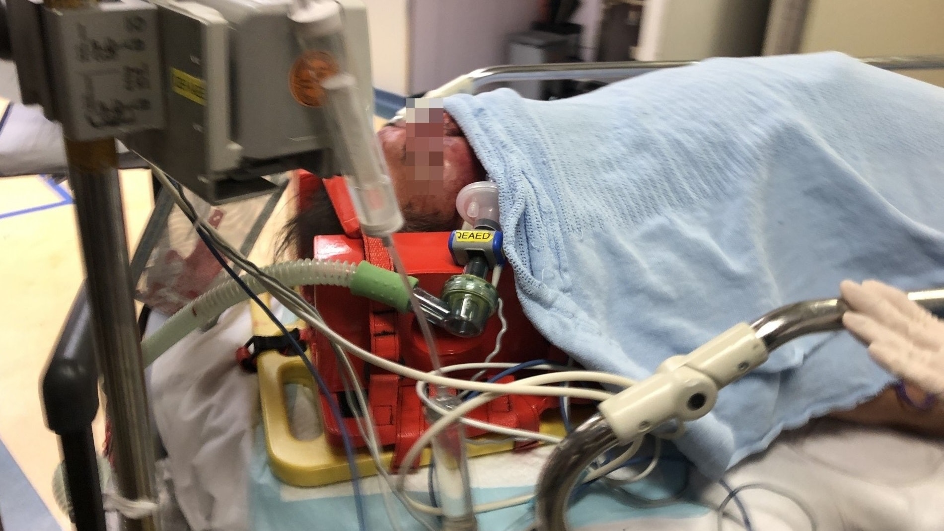 【殺人爆竊】揭酒樓爆竊遭「滅口」 觀塘老保安被扑頭殉職 【殺人爆竊】揭酒樓爆竊遭「滅口」 觀塘老保安被扑頭殉職