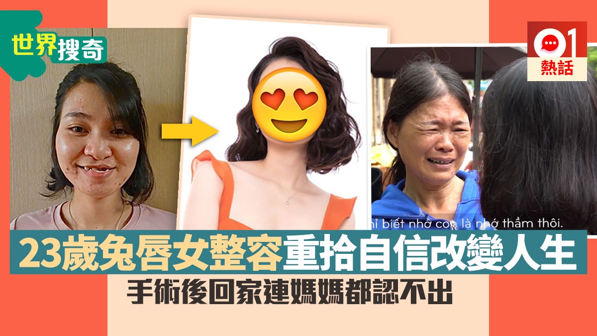 越南女天生兔唇求職失敗整容後人生逆轉母見女兒變美激動痛哭 香港01 熱爆話題