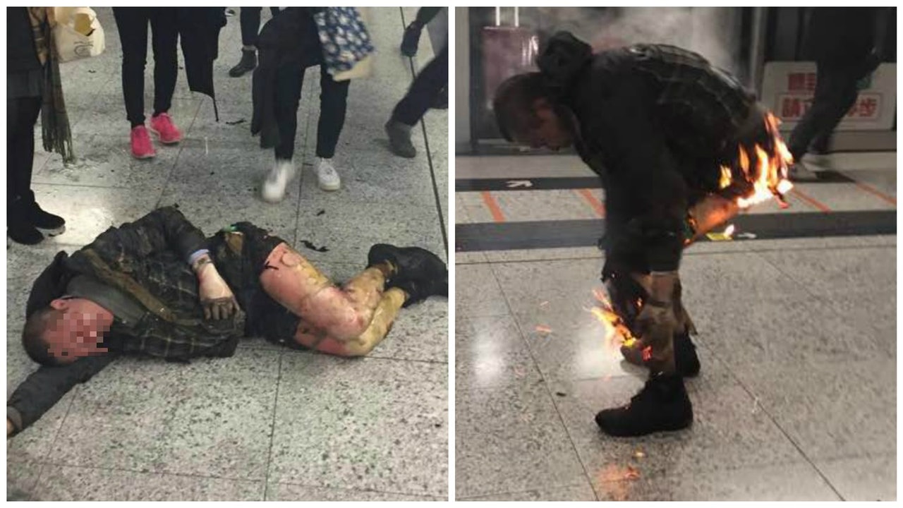 【港鐵烈火】兩傷者危殆 縱火男3級燒傷 醫生:會燒至無痛感 【港鐵烈火】兩傷者危殆 縱火男3級燒傷 醫生:會燒至無痛感