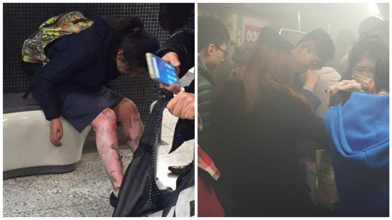 【港鐵烈火】初中女生雙腿燒至脫皮 目擊者:如坐上屍殺列車 【港鐵烈火】初中女生雙腿燒至脫皮 目擊者:如坐上屍殺列車