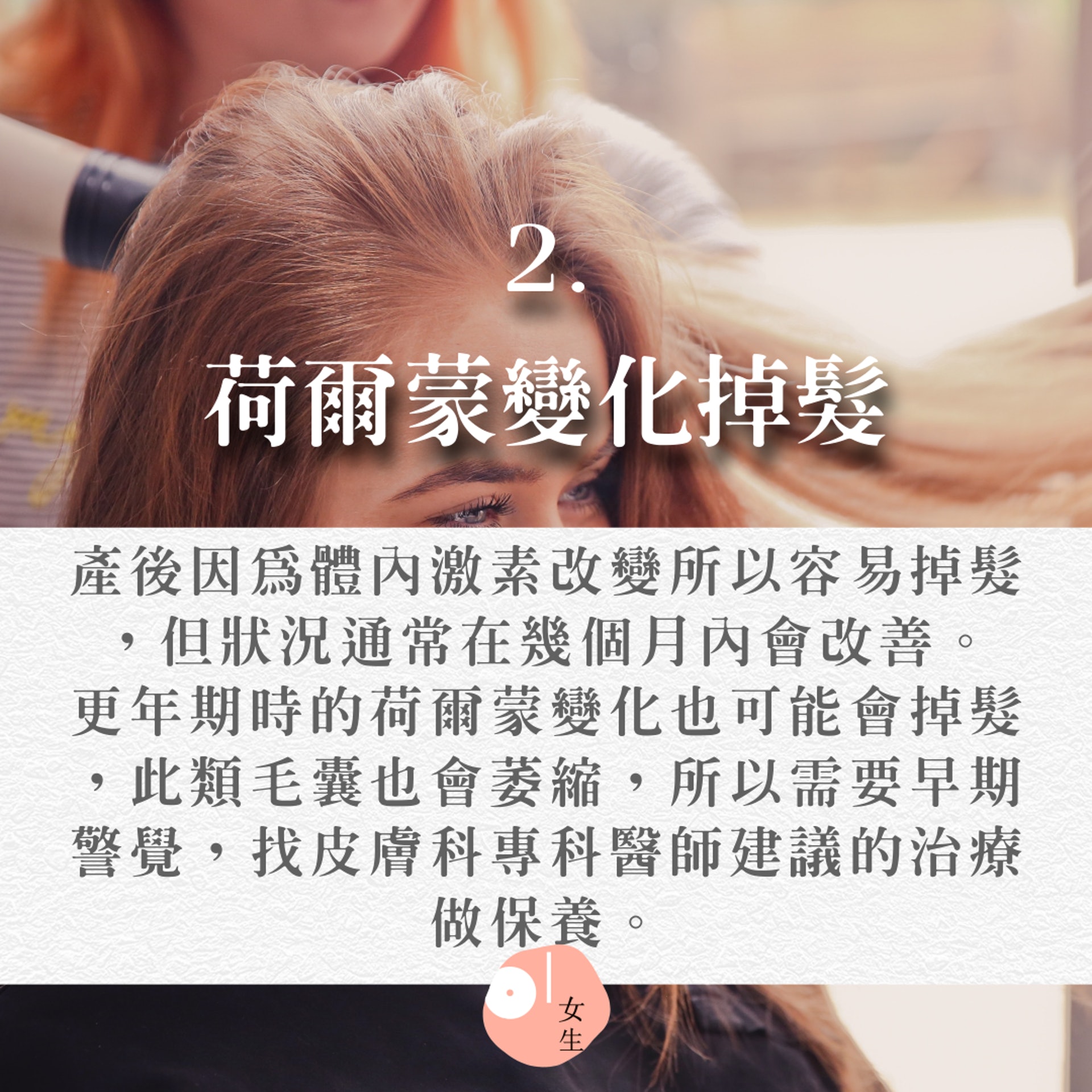 【11個會掉髮的原因】(Unsplash@Theme Photos/香港01製圖/414409) 【11個會掉髮的原因】(Unsplash@Theme Photos/香港01製圖/414409)