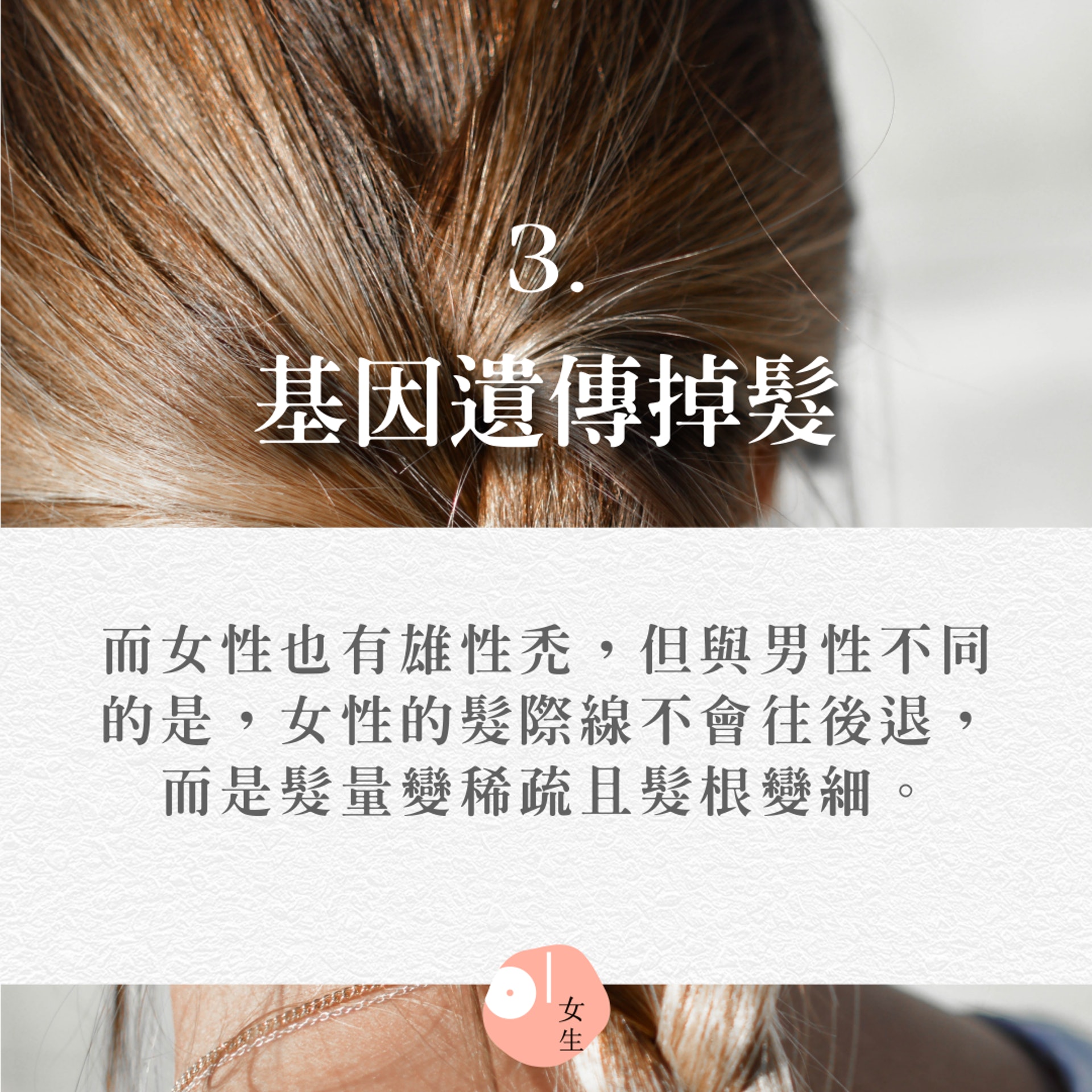 【11個會掉髮的原因】(Unsplash@Tamara Bellis/香港01製圖/414409) 【11個會掉髮的原因】(Unsplash@Tamara Bellis/香港01製圖/414409)